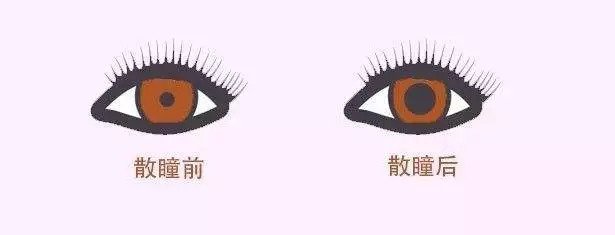 配眼鏡還散瞳，散瞳對(duì)眼睛有傷害嗎