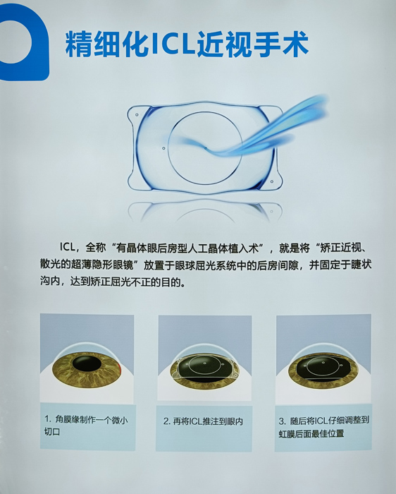 寒假摘鏡總動(dòng)員，近視朋友的三種矯正近視方式